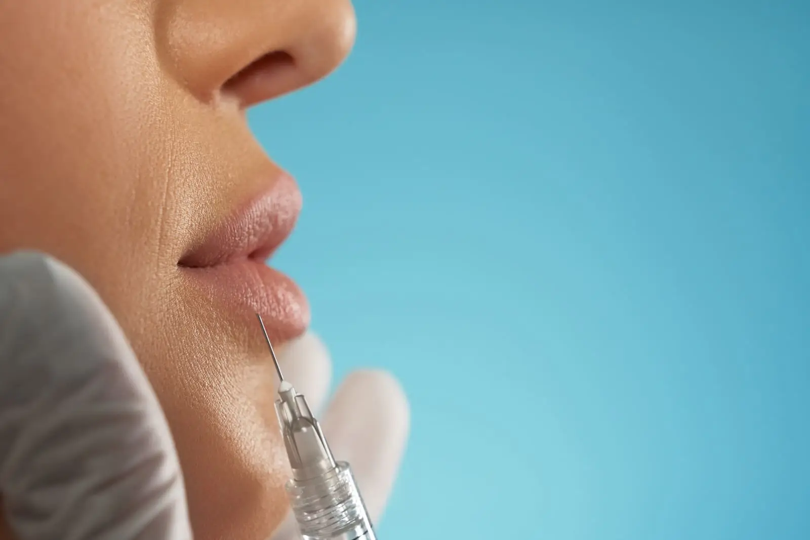 Filler Labbra